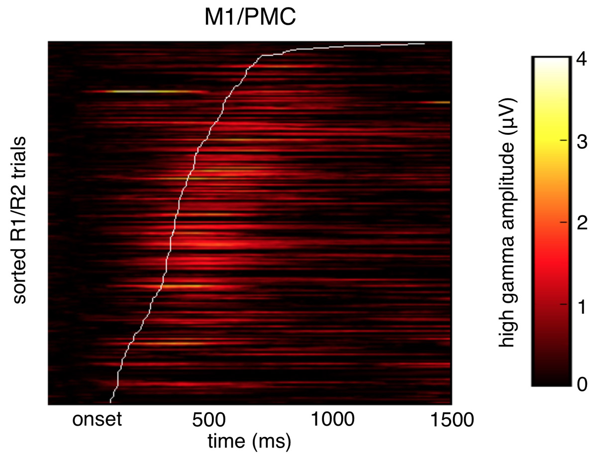 Voytek et al., Nature Neuroscience Figure S2