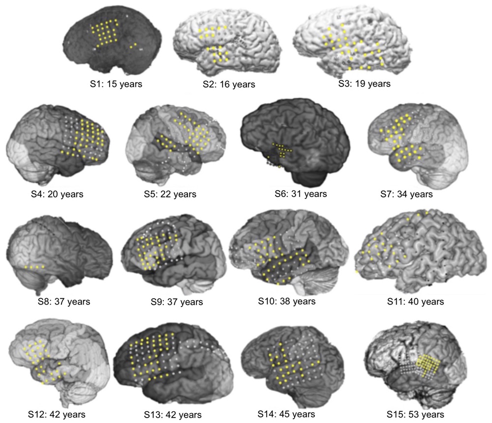 voytek_jneurosci2015_fig1