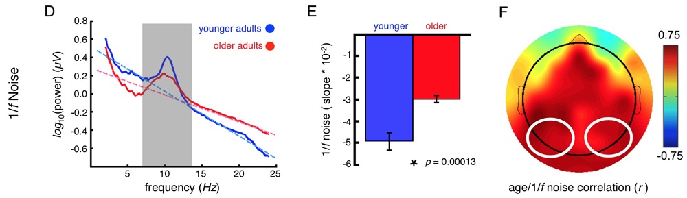 voytek_jneurosci2015_fig3_bot