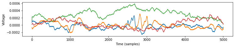 ../_images/tutorials_plot_2_bids_8_0.png